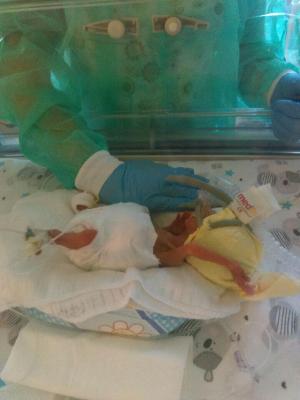 Szymek - Najmniejszy wcześniak w histiorii spsk2(2)